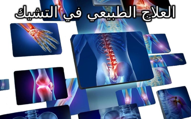 العلاج الطبيعي في التشيك